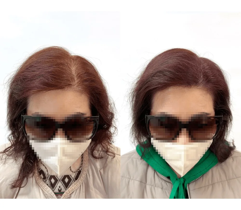 헤어라인, 가르마, 정수리