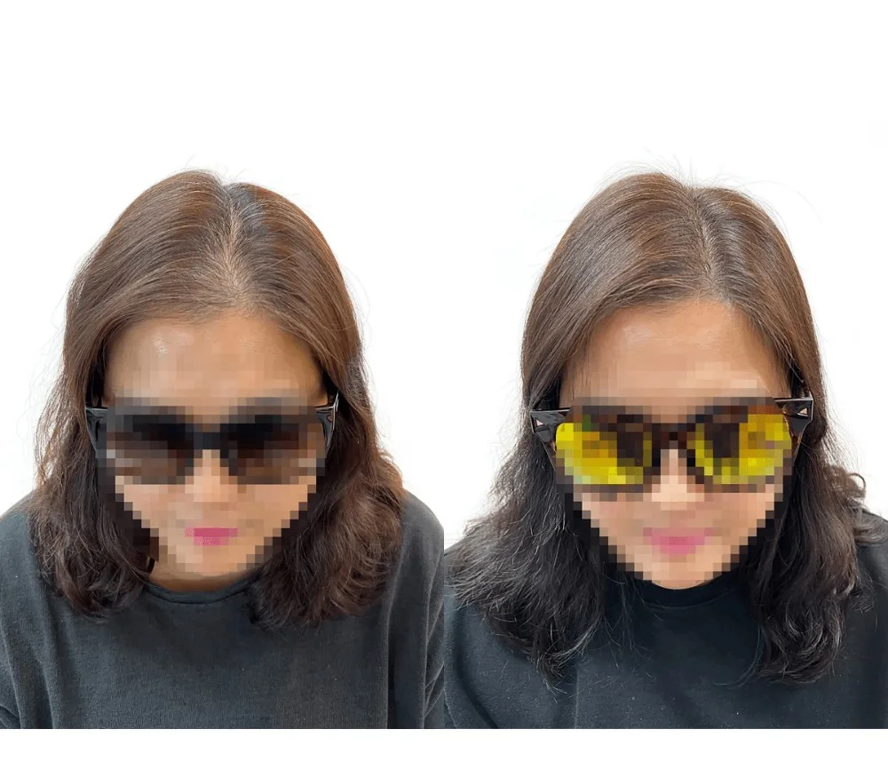 헤어라인, 가르마, 정수리